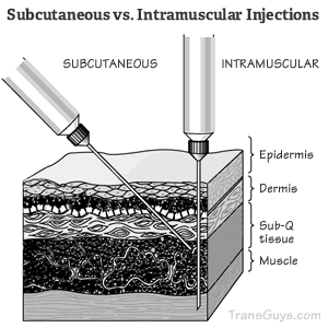 Subcutaneous injection vs. IM injection - Testosterone